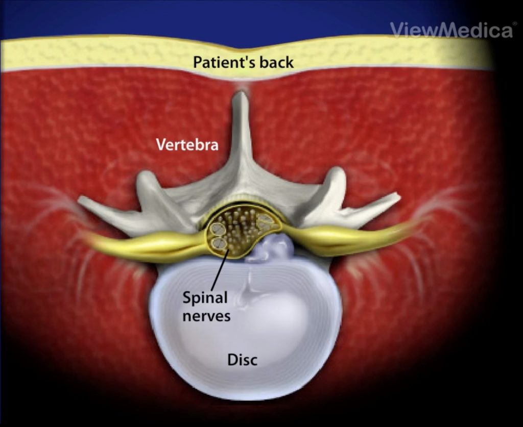 4-Corte-axial-1024x837 Cirurgia Endoscópica